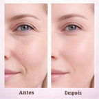 Medicube - PDRN Pink Collagen Volume Multi Balm (Bálsamo Reafirmante Multiusos) 10g